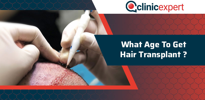 What Age To Get Hair Transplant?