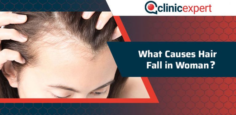 What Causes Hair Fall in Woman? | ClinicExpert