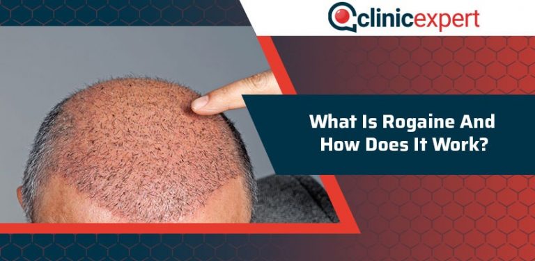 does rogaine work after hair transplant