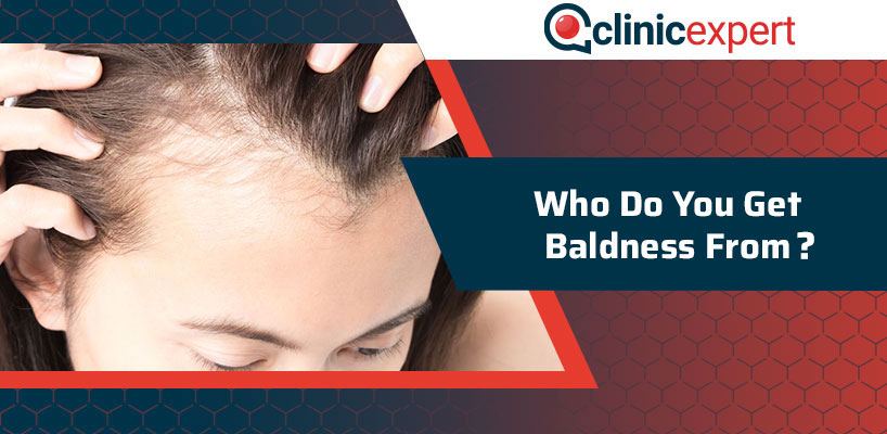 Who Do You Get Baldness From?