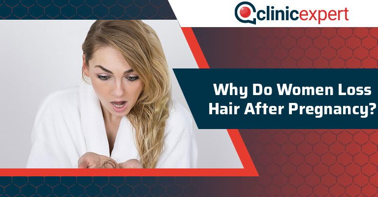 Why Do Women Loss Hair After Pregnancy?