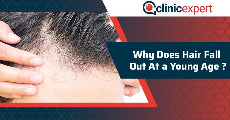 Why Does Hair Fall Out At a Young Age?
