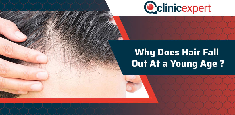 Why Does Hair Fall Out At a Young Age?