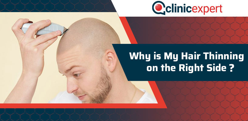 Why Is My Hair Thinning On The Side? | ClinicExpert