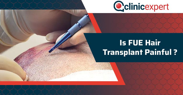 Is FUE Hair Transplant Painful?