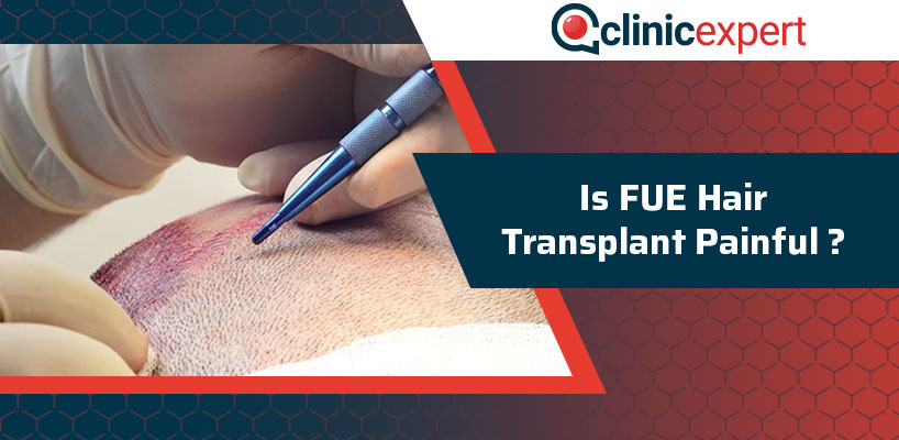 Is FUE Hair Transplant Painful?