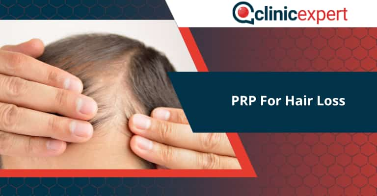 PRP for Hair Loss