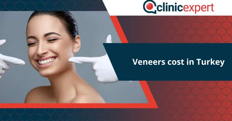 Veneers cost in Turkey