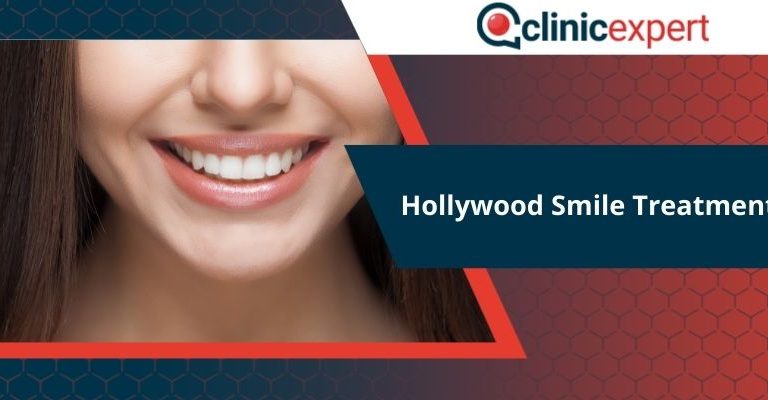 Hollywood Smile Treatment