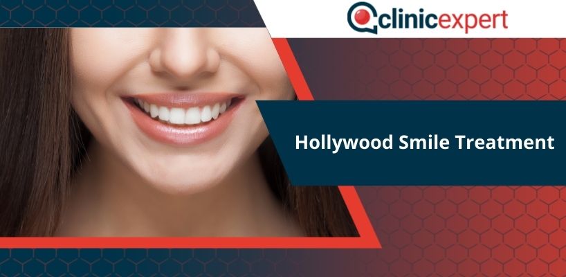 Hollywood Smile Treatment