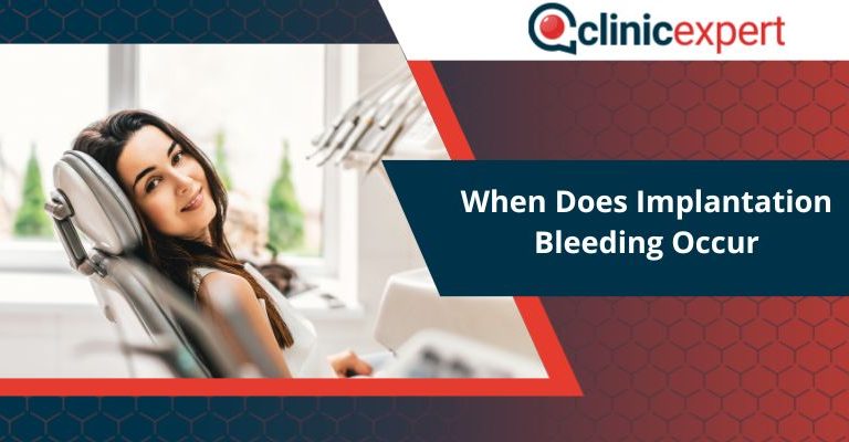 When Does Implantation Bleeding Occur