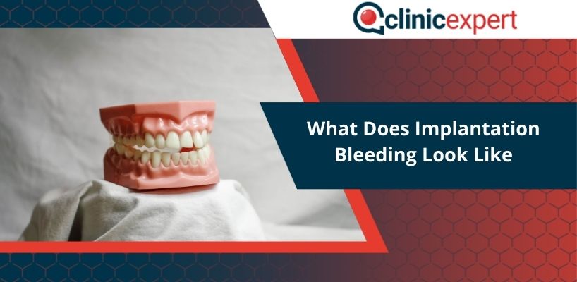 What Does Implantation Bleeding Look Like
