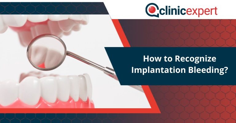 How to Recognize Implantation Bleeding