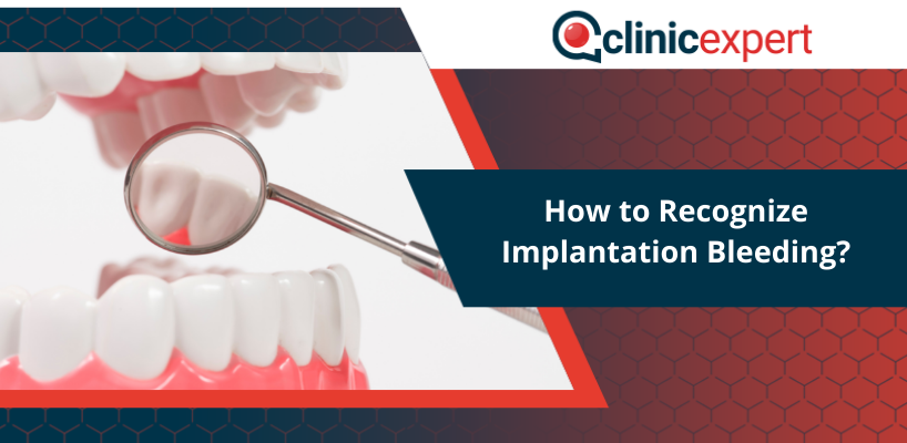 How to Recognize Implantation Bleeding