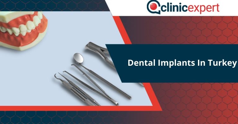 Dental Implants In Turkey