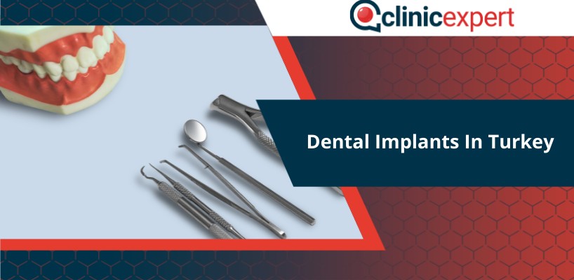 Dental Implants In Turkey