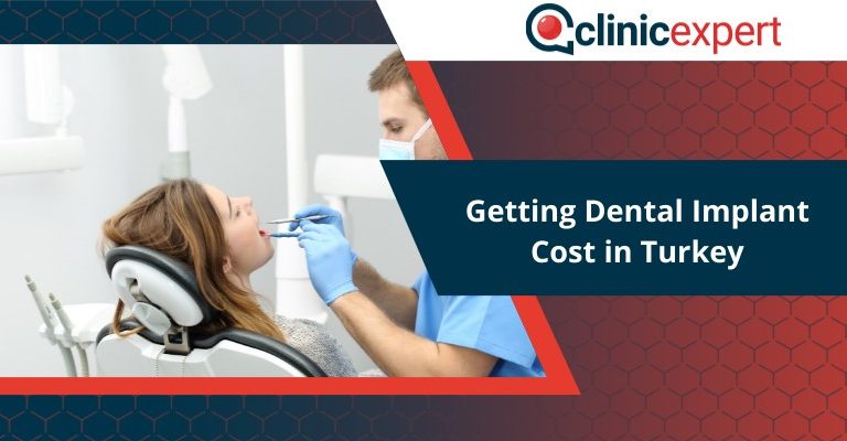 Getting Dental Implant Cost in Turkey