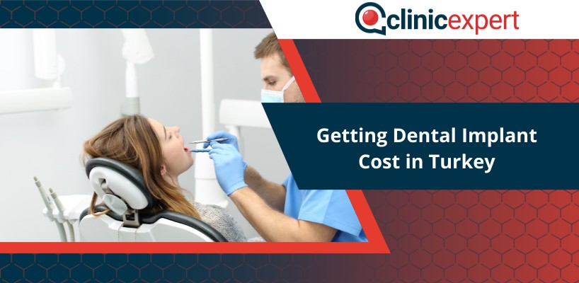 Getting Dental Implant Cost in Turkey