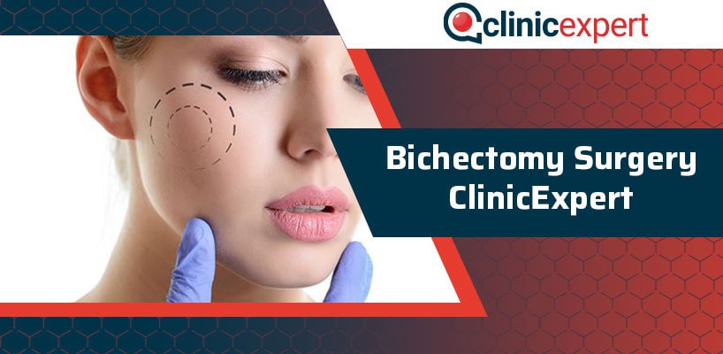 bichectomy Clinicexpert