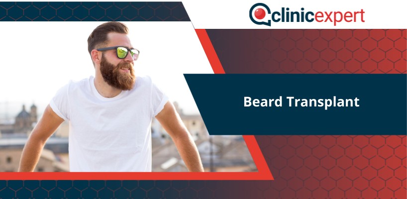 Beard Transplant