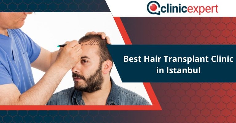 Best Hair Transplant Clinic in Istanbul