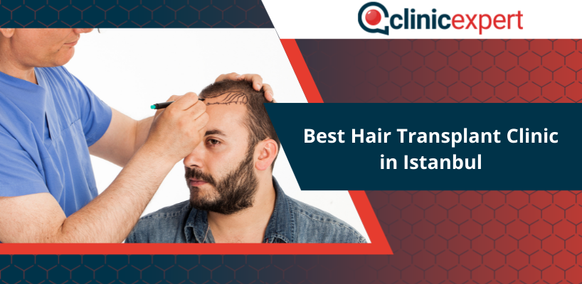 Best Hair Transplant Clinic in Istanbul