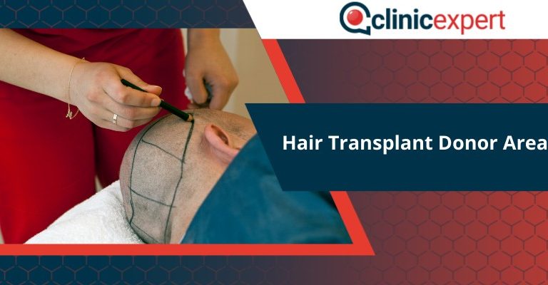 Hair Transplant Donor Area