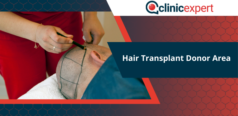 Hair Transplant Donor Area