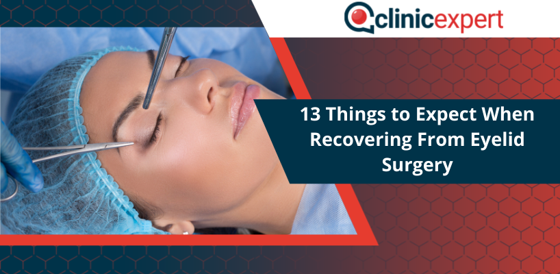 13 Things to Expect When Recovering From Eyelid Surgery