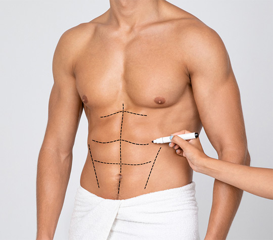 Liposuction in Turkey