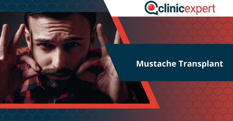 Mustache transplant