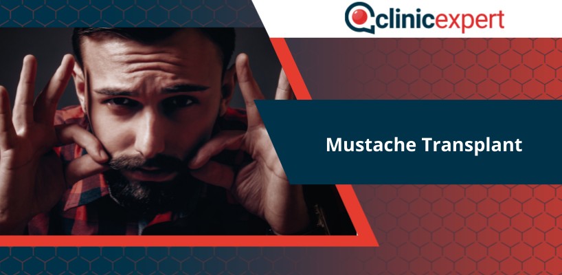 Mustache transplant