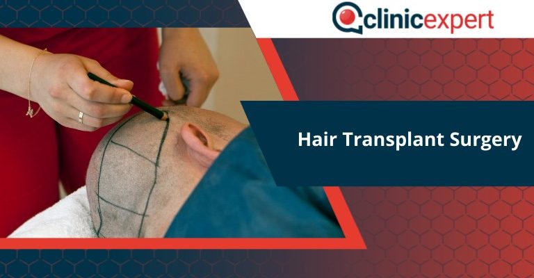 Hair Transplant Surgery