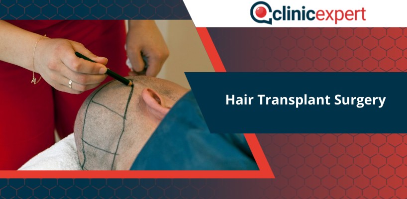 Hair Transplant Surgery