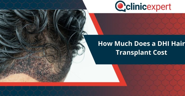 How Much Does a DHI Hair Transplant Cost