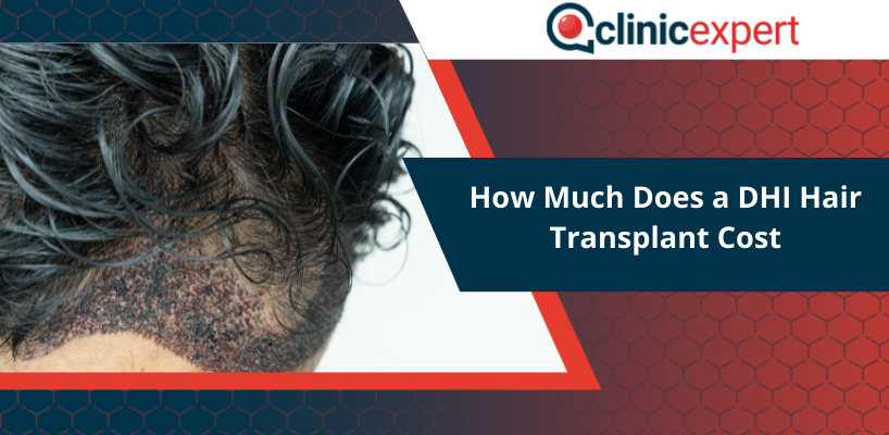 How Much Does a DHI Hair Transplant Cost | Clinicexpert