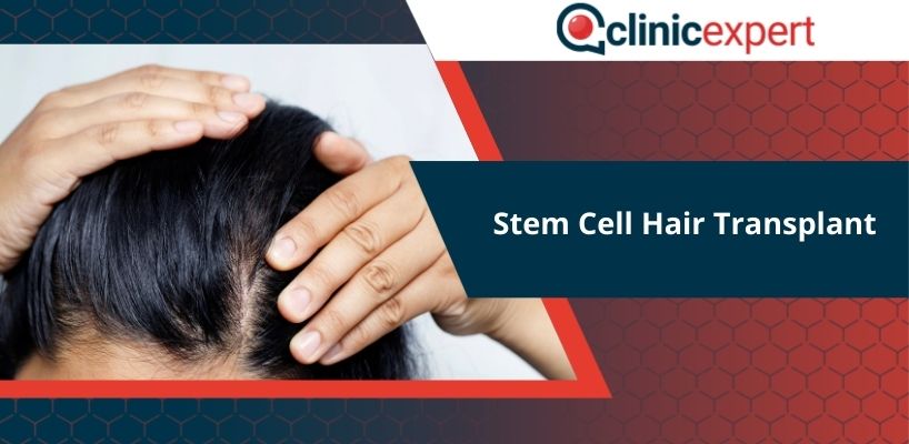 Stem Cell Hair Transplant | Clinicexpert International Healthcare Service