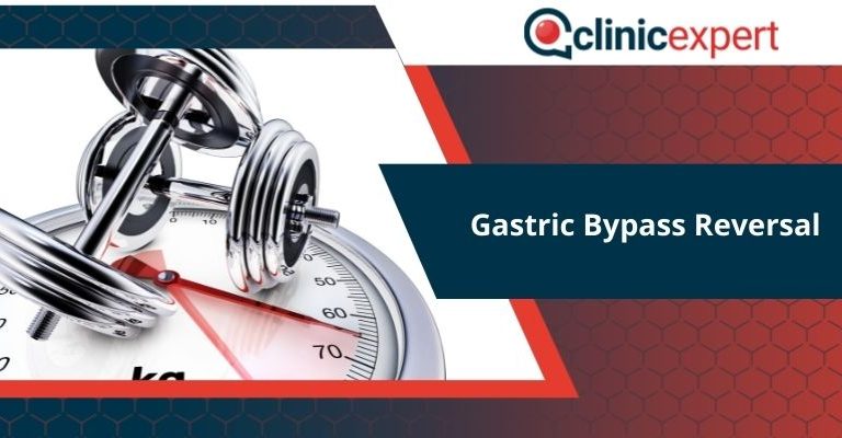 Gastric Bypass Reversal