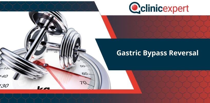 Gastric Bypass Reversal