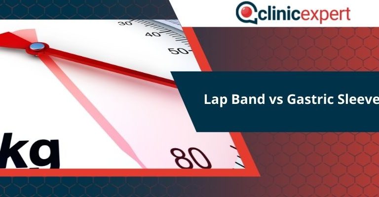 Lap Band vs Gastric Sleeve