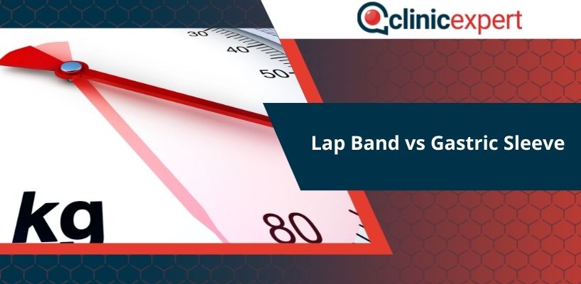 Lap Band vs Gastric Sleeve