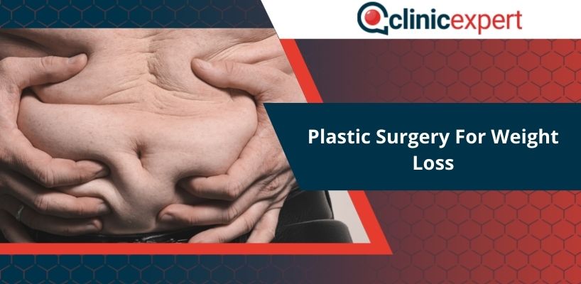 Plastic Surgery For Weight Loss