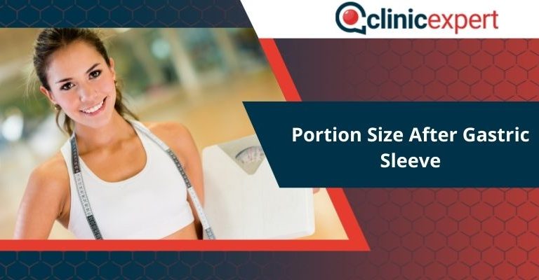 Portion Size After Gastric Sleeve