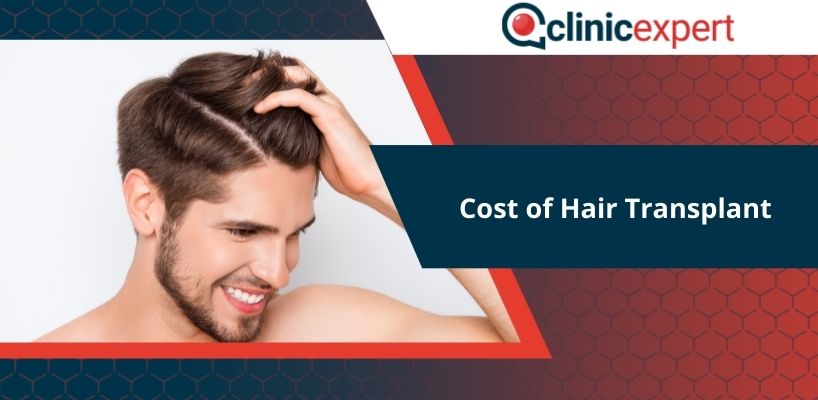 Cost of Hair Transplant