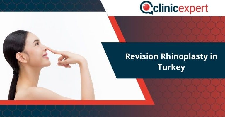 Revision Rhinoplasty in Turkey