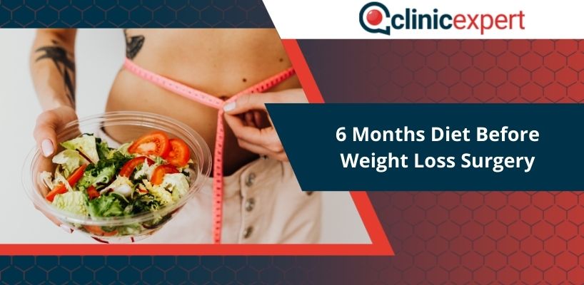 6 Months Diet Before Weight Loss Surgery