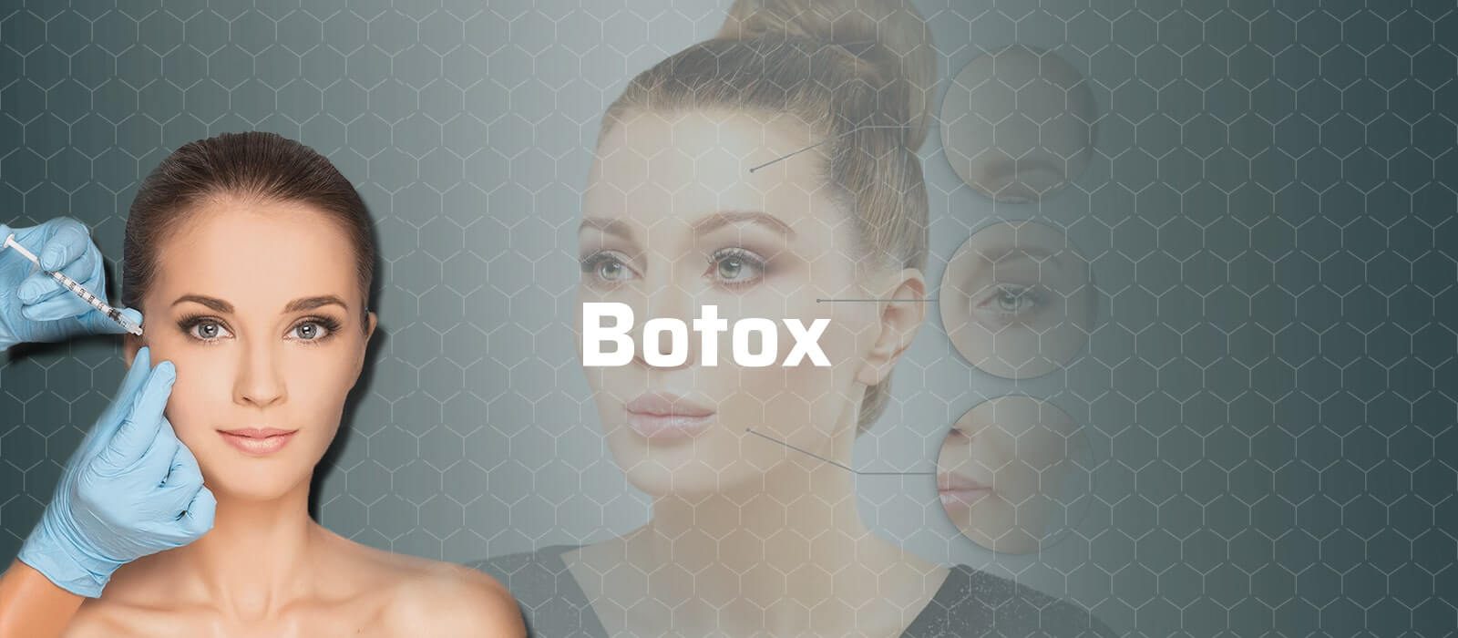botox