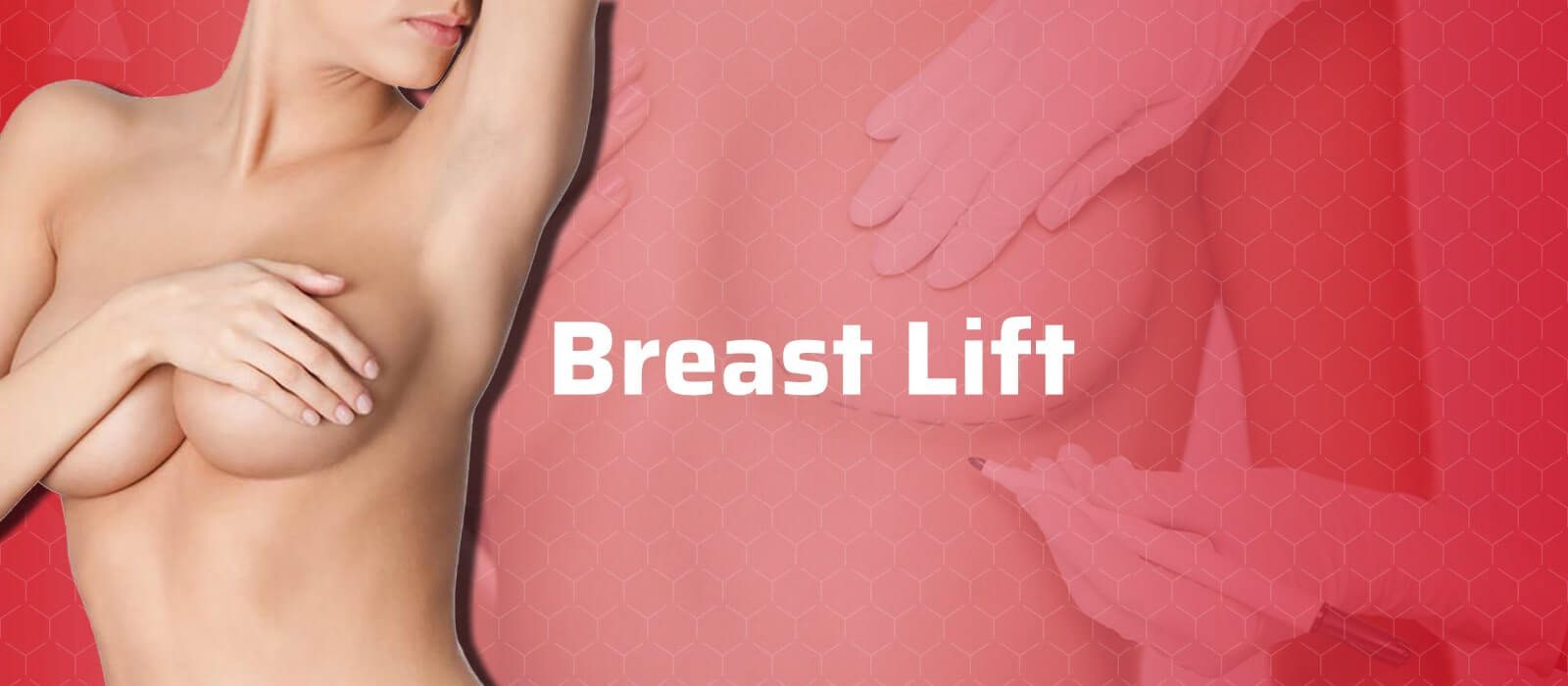 Breast-Lift-min