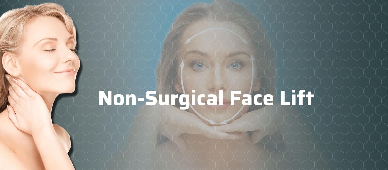 Non-Surgical Face Lift