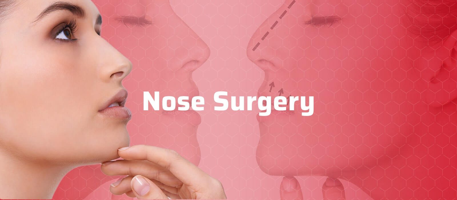 Nose Surgery